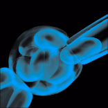 Embryo, dem eine Zelle zur Untersuchung entnommen wird (PID)