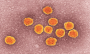 Hepatitis_C