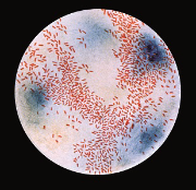 Haemophilus_influenzae