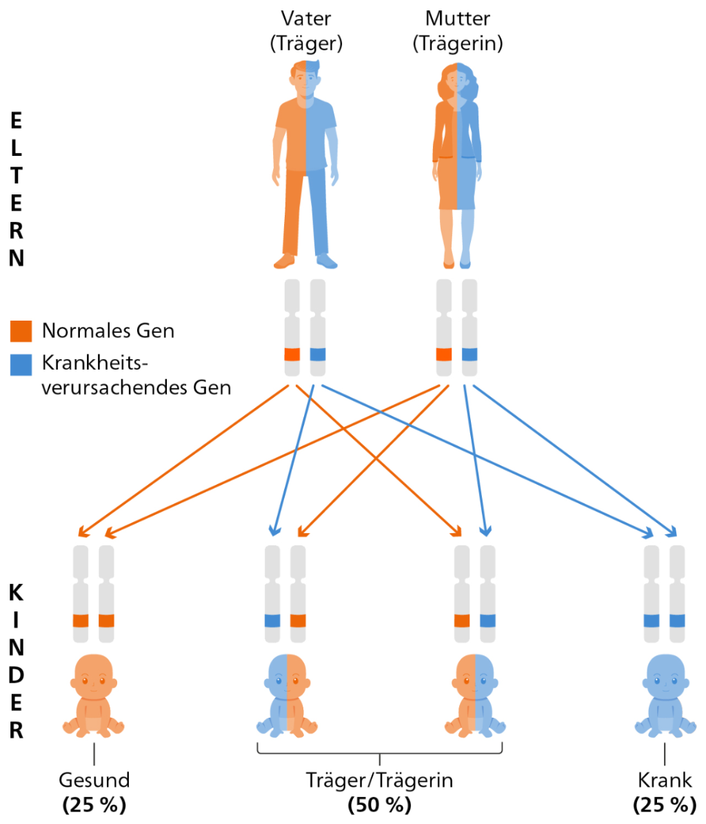 Kernaussage der Infografik: «Träger» tragen nur eine Kopie eines krankheitsverursachenden Gens und sind selbst gesund. Wenn zwei Träger miteinander Kinder bekommen, besteht eine 25-prozentige Wahrscheinlichkeit, dass das Kind 2 Kopien des krankheitsverursachenden Gens erbt und die Krankheit ausbricht. In 50 Prozent der Fälle erbt das Kind nur eine Kopie des krankheitsverursachenden Gens und gilt selbst als Träger bzw. Trägerin. In den restlichen 25 Prozent erbt das Kind zwei normale Kopien des Gens und gilt als gesund.