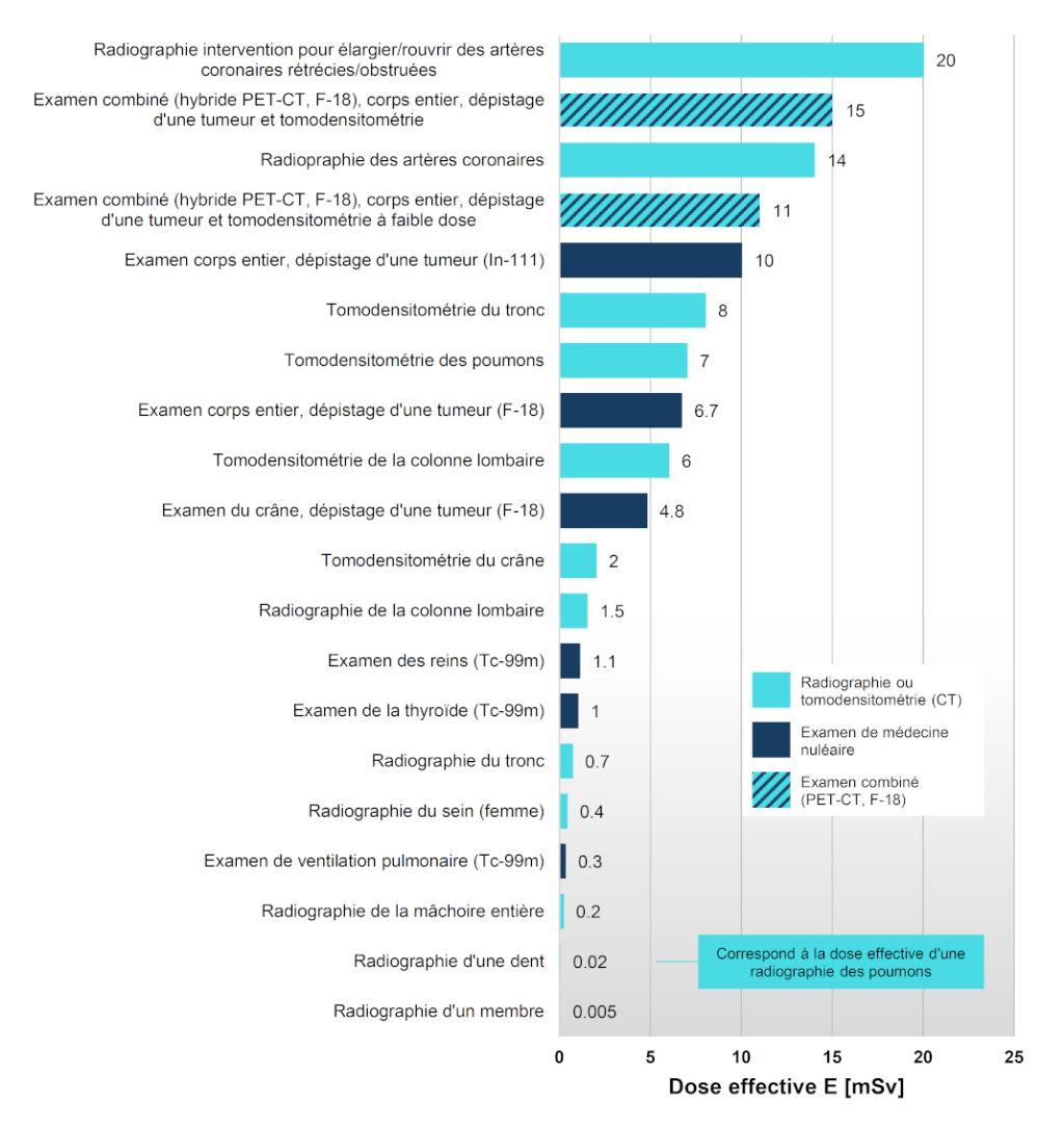 Doses de rayonnement caractéristiques par examen