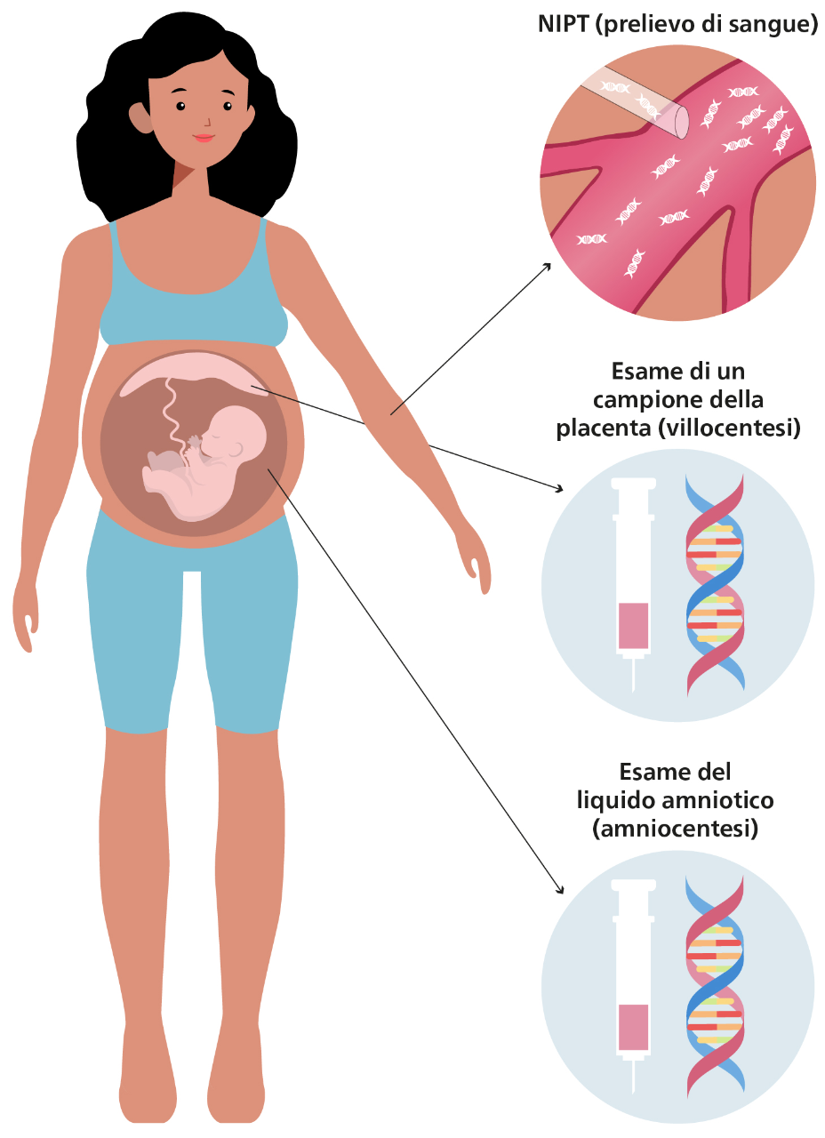 Contenuto del grafico informativo: panoramica dei diversi test genetici (invasivi e non invasivi) durante la gravidanza. Tutte le informazioni sono contenute nel testo.